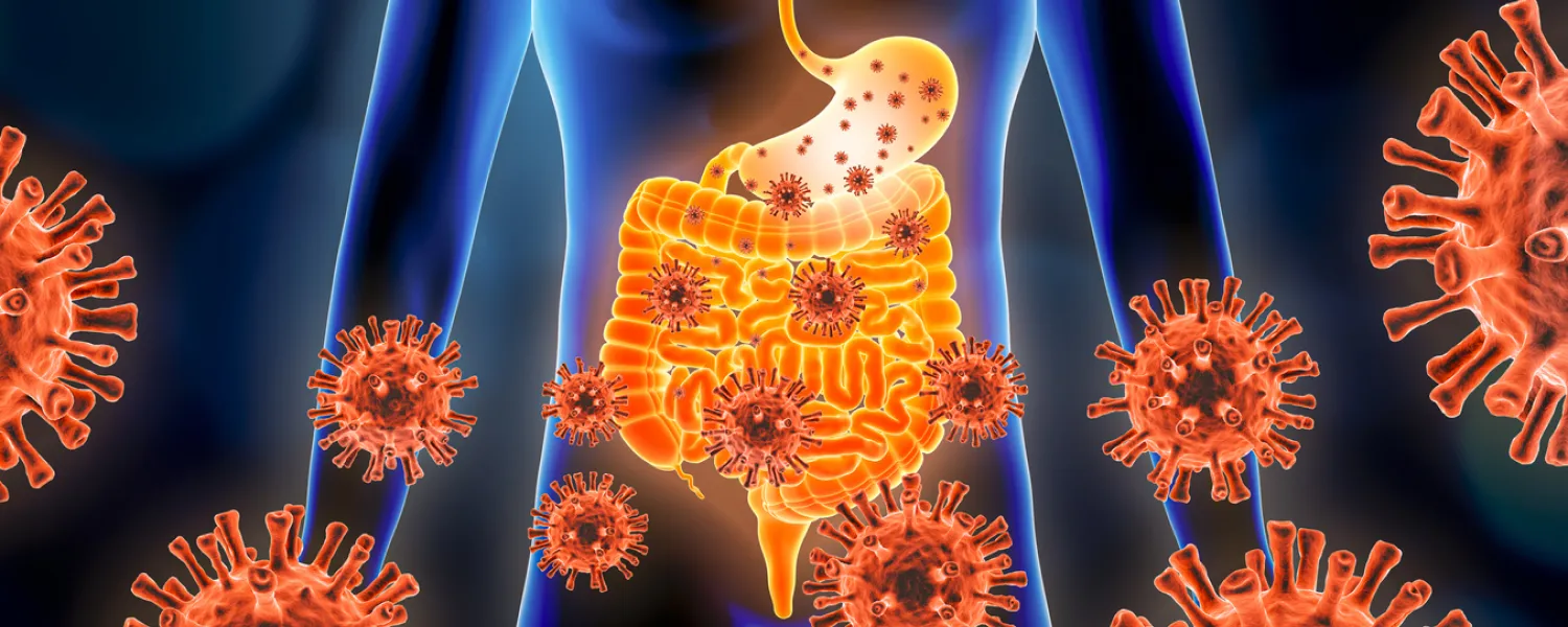 Illustration of inflammation in the human gut, highlighting areas affected by irritation and swelling.